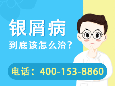 黑龙江治疗牛皮癣去哪家医院好