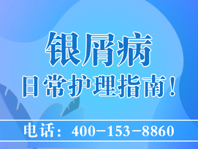 黑龙江哪所医院治银屑病好