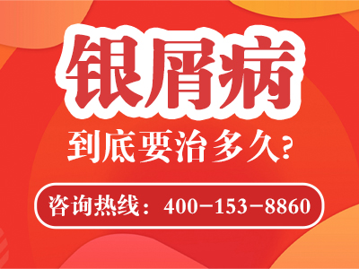 黑龙江银屑病医院哪家好
