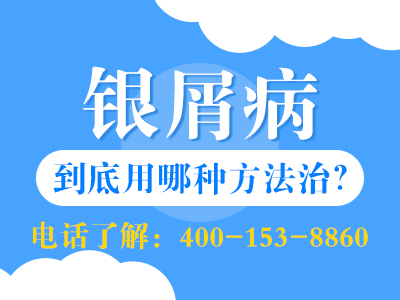 哈尔滨银屑病治疗去哪家医院好