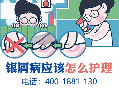 在哈尔滨治银屑病哪家医院技术水平高