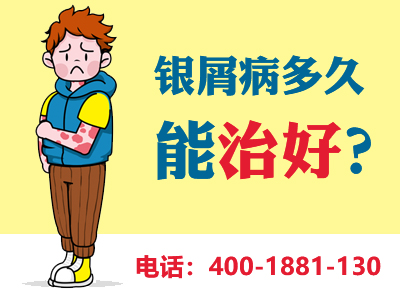 哈尔滨公营的银屑病医院哪个指标客观