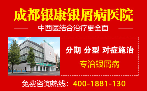 哈尔滨哪家专科银屑病医院信誉高