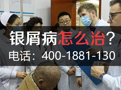 ​哈尔滨银屑病医院怎么样